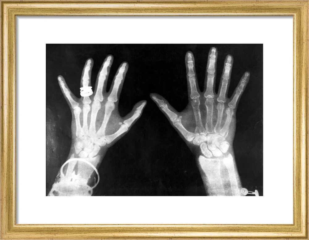 X-rays of the hands of King George and Queen Mary, 1896. - Image 10