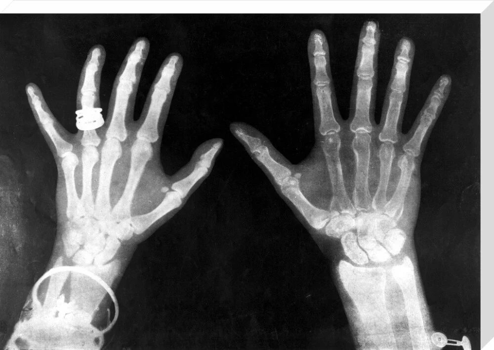 X-rays of the hands of King George and Queen Mary, 1896. - Image 100
