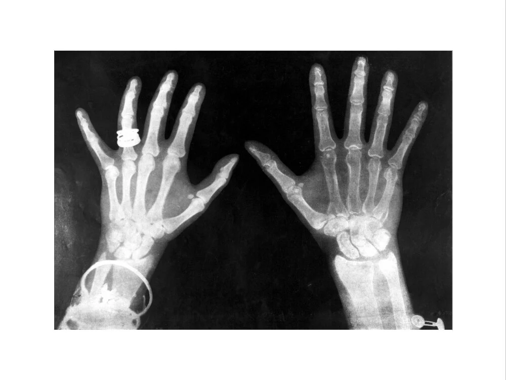 X-rays of the hands of King George and Queen Mary, 1896. - Image 12