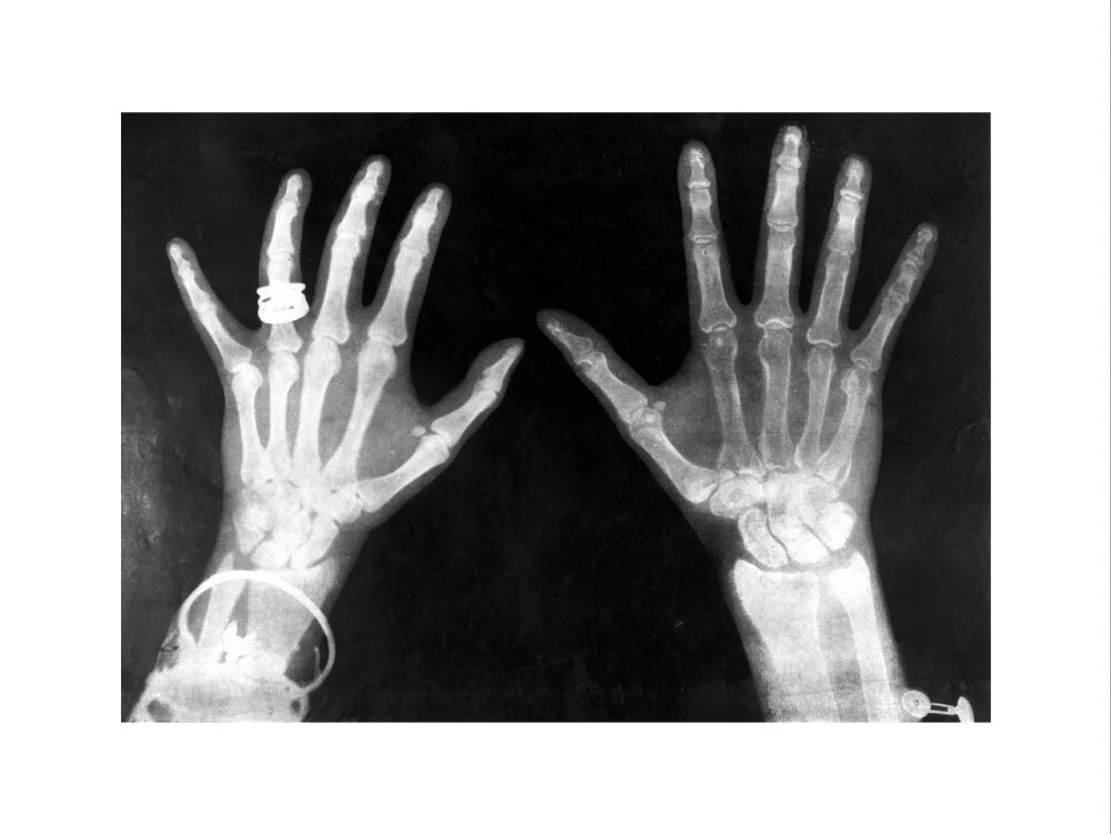 X-rays of the hands of King George and Queen Mary, 1896. - Image 17