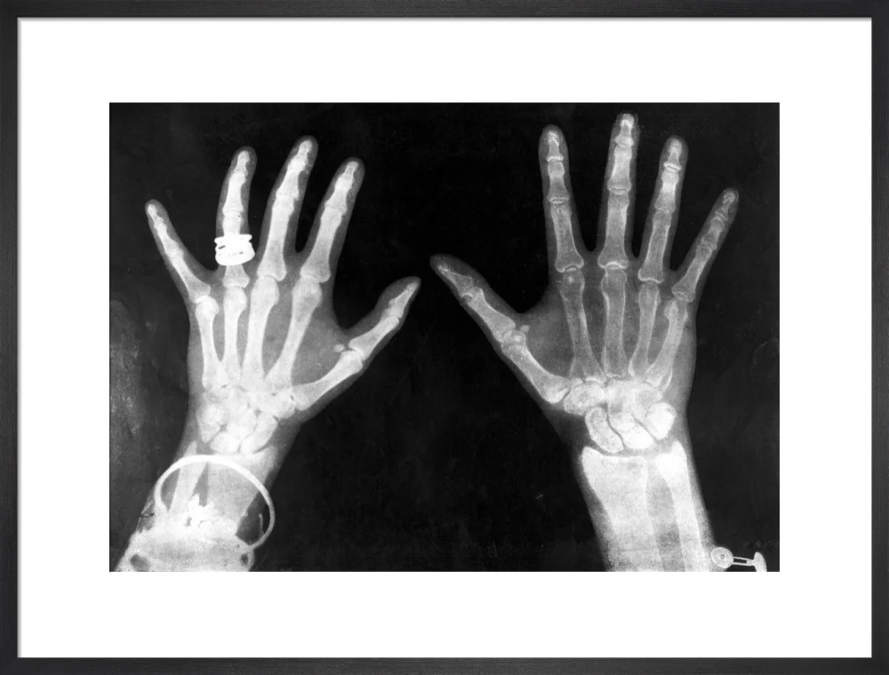X-rays of the hands of King George and Queen Mary, 1896. - Image 18
