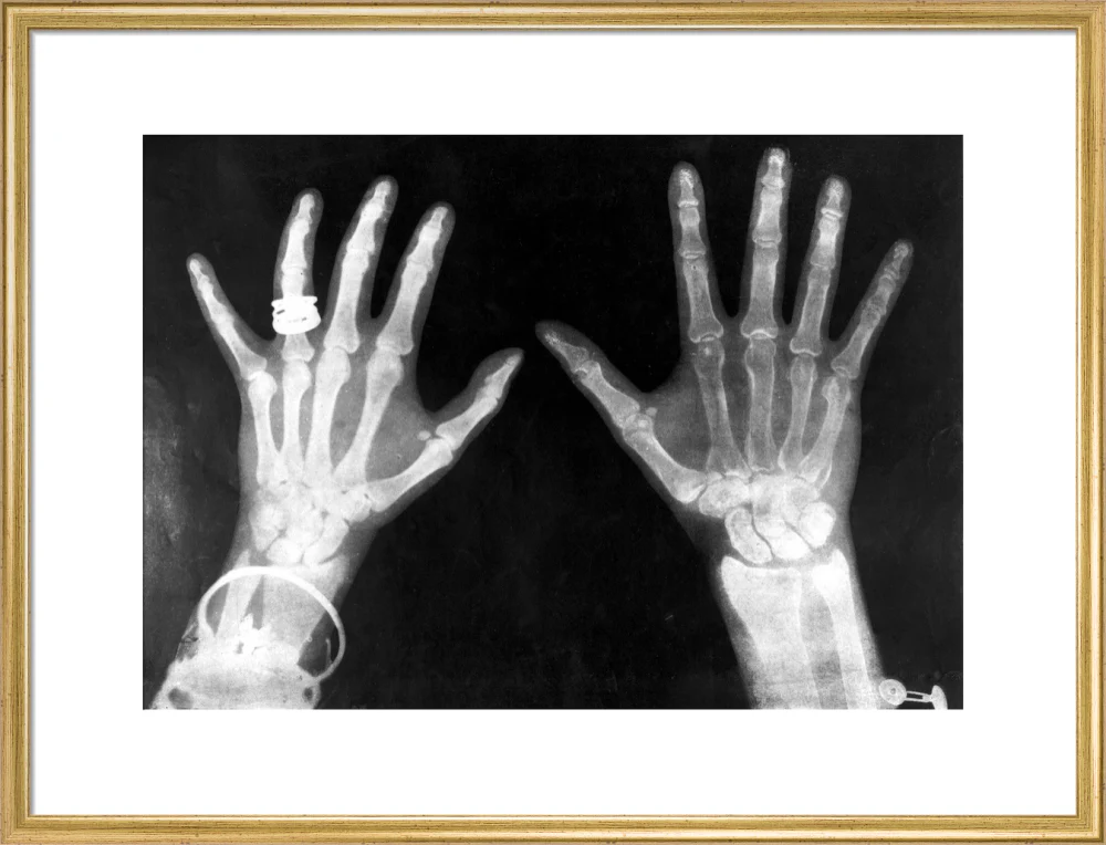 X-rays of the hands of King George and Queen Mary, 1896. - Image 20