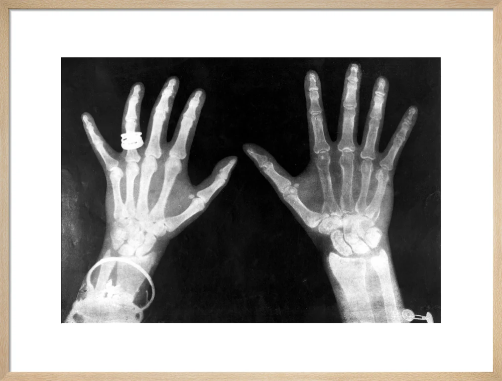 X-rays of the hands of King George and Queen Mary, 1896. - Image 21