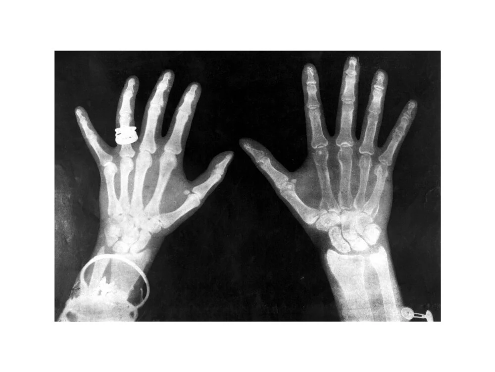 X-rays of the hands of King George and Queen Mary, 1896. - Image 22