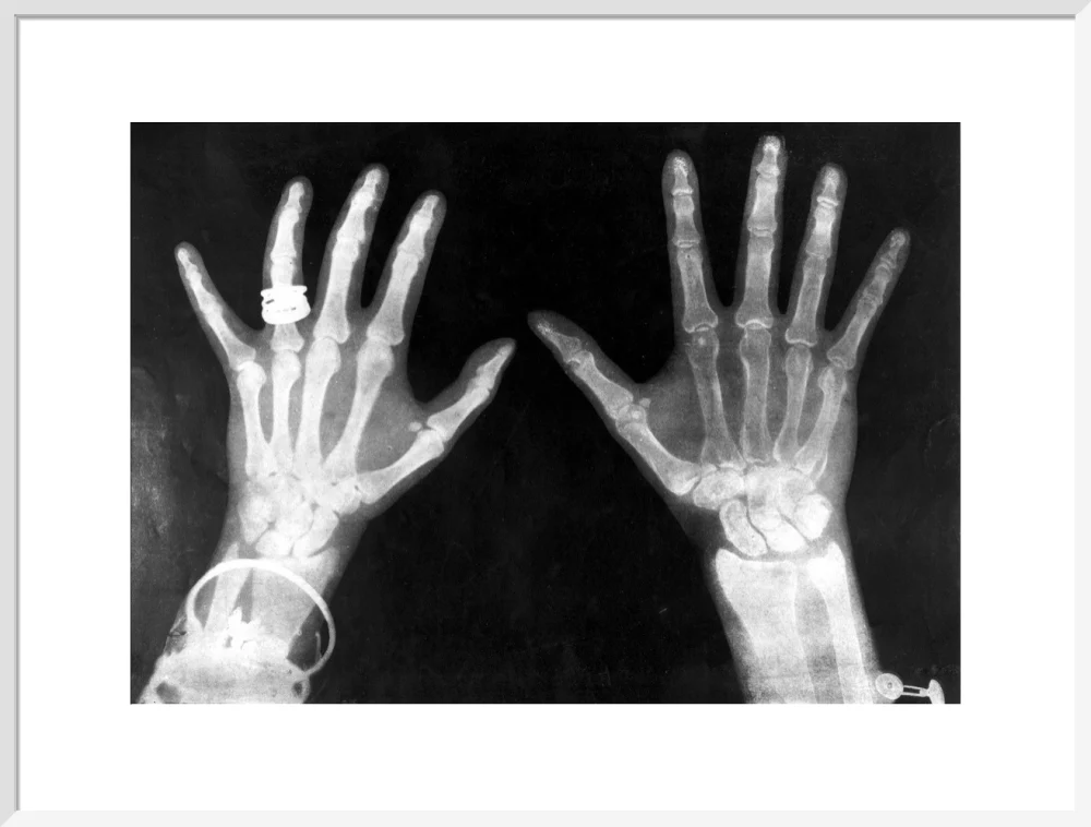 X-rays of the hands of King George and Queen Mary, 1896. - Image 24