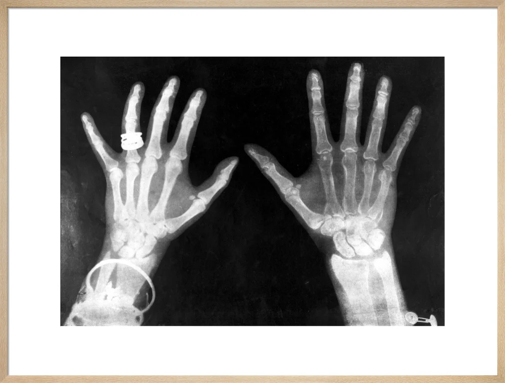 X-rays of the hands of King George and Queen Mary, 1896. - Image 26