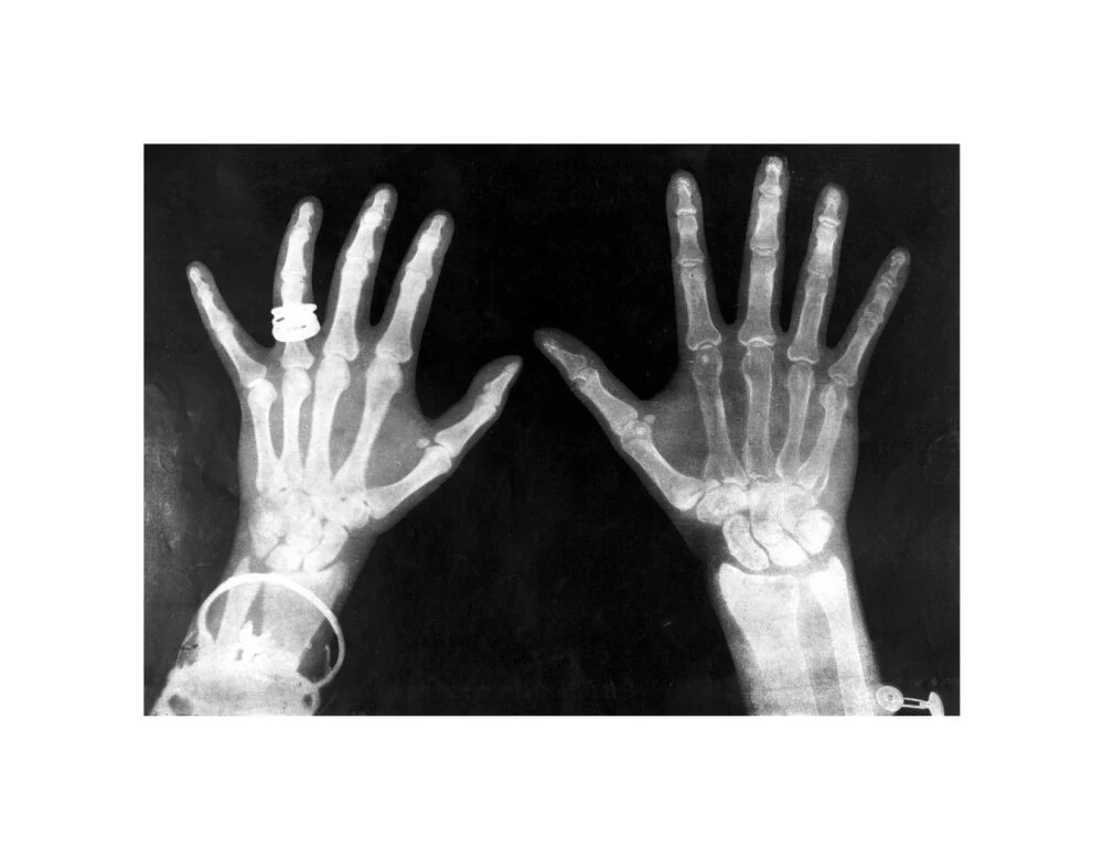 X-rays of the hands of King George and Queen Mary, 1896. - Image 27