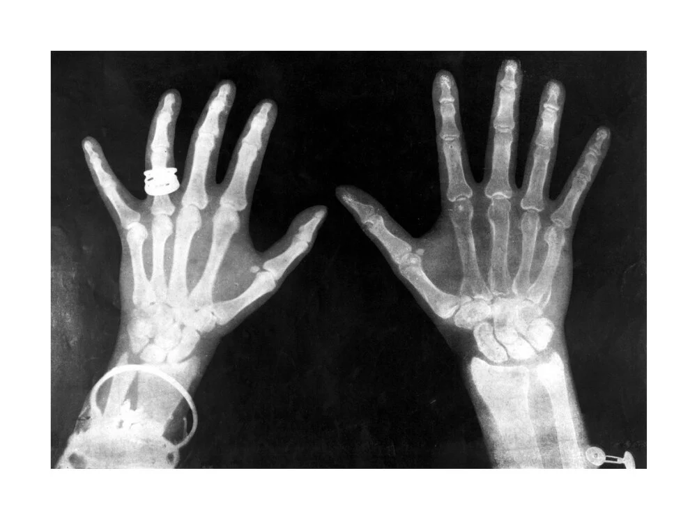 X-rays of the hands of King George and Queen Mary, 1896. - Image 29