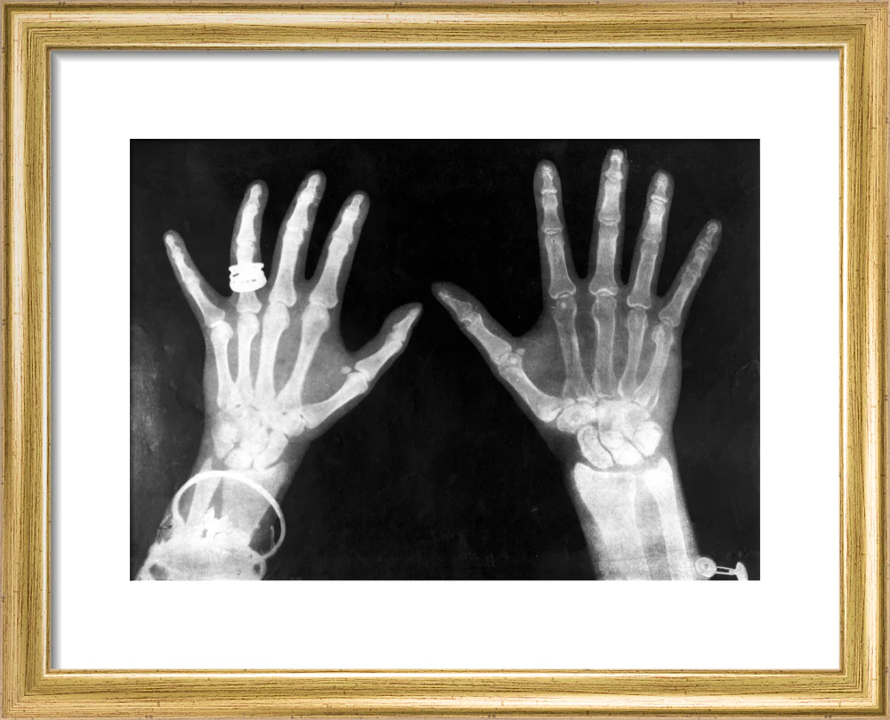 X-rays of the hands of King George and Queen Mary, 1896. - Image 38