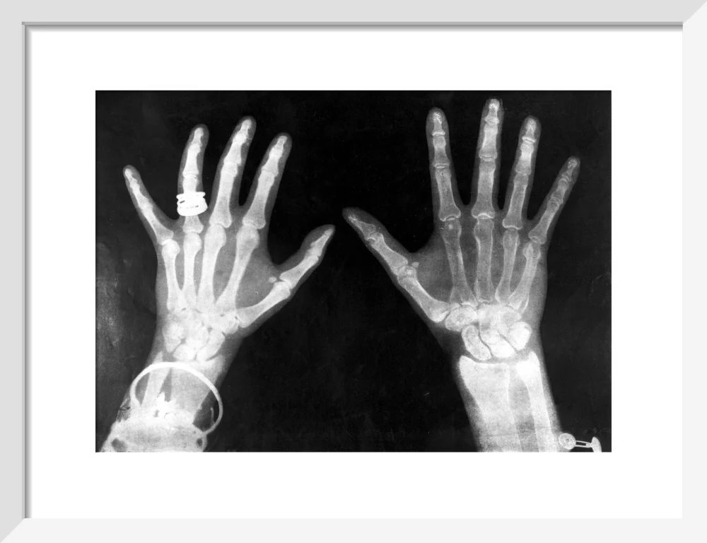X-rays of the hands of King George and Queen Mary, 1896. - Image 42