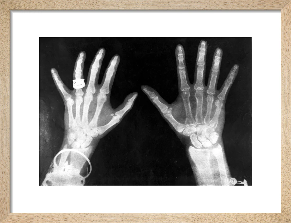 X-rays of the hands of King George and Queen Mary, 1896. - Image 44