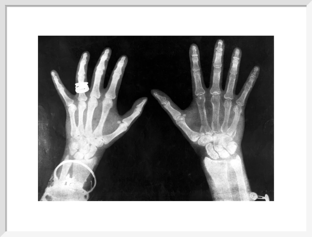 X-rays of the hands of King George and Queen Mary, 1896. - Image 52