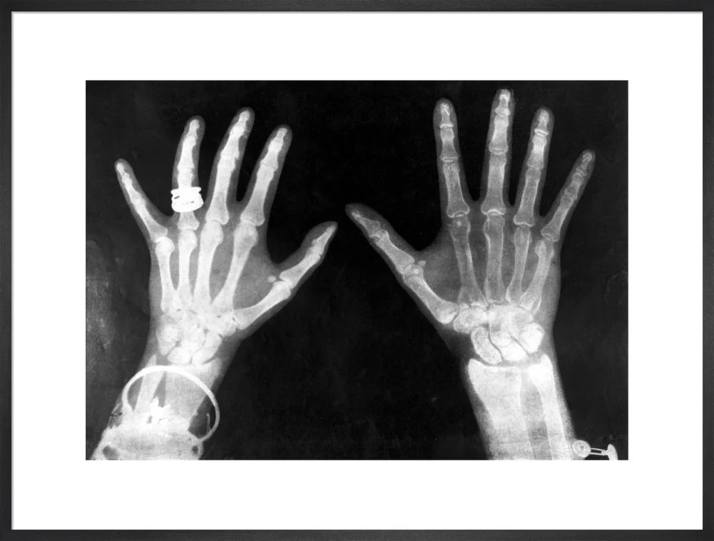 X-rays of the hands of King George and Queen Mary, 1896. - Image 56