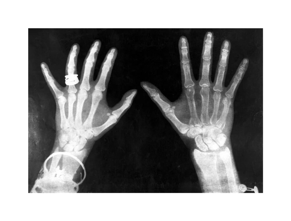 X-rays of the hands of King George and Queen Mary, 1896. - Image 61
