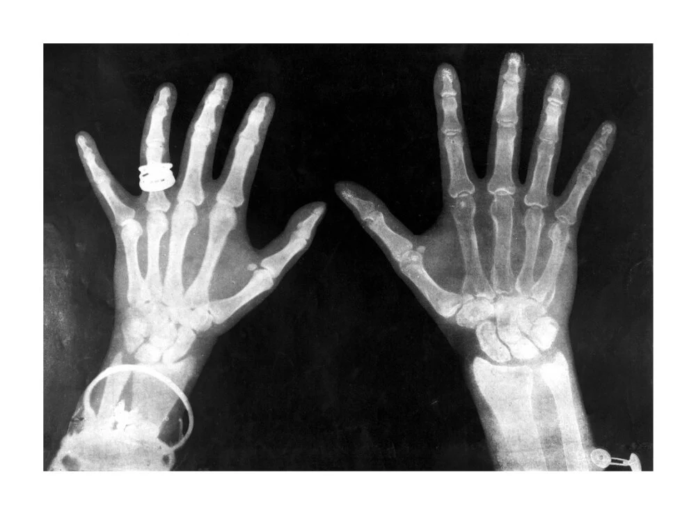 X-rays of the hands of King George and Queen Mary, 1896. - Image 63