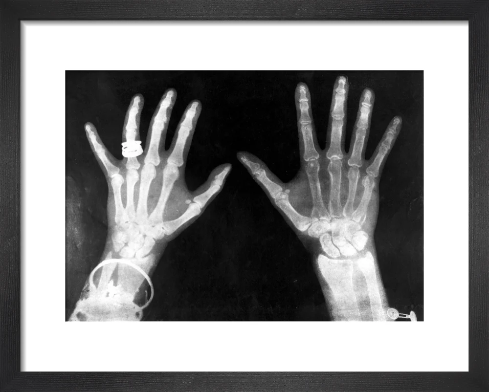 X-rays of the hands of King George and Queen Mary, 1896. - Image 69