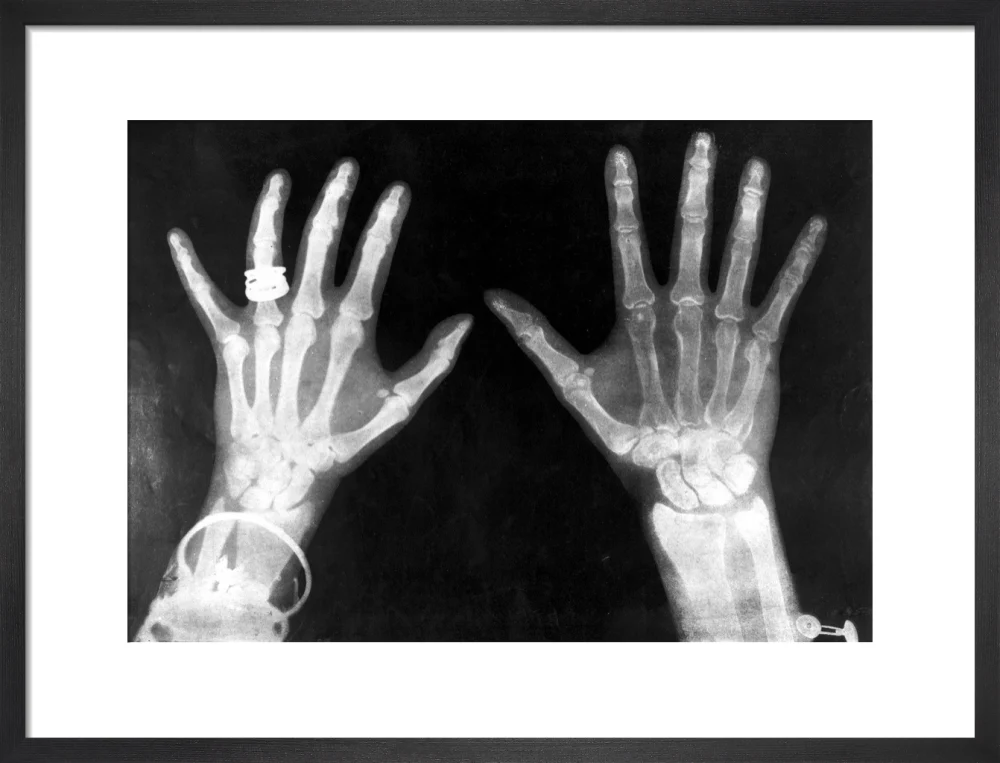 X-rays of the hands of King George and Queen Mary, 1896. - Image 79