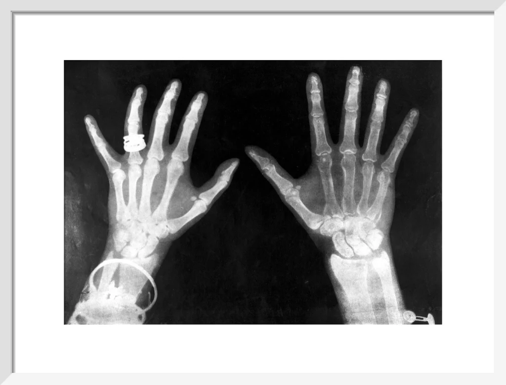 X-rays of the hands of King George and Queen Mary, 1896. - Image 80