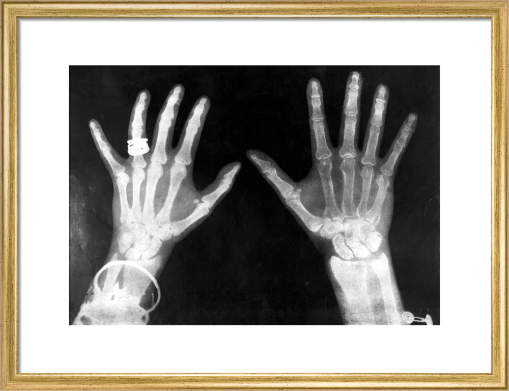 X-rays of the hands of King George and Queen Mary, 1896. - Image 81