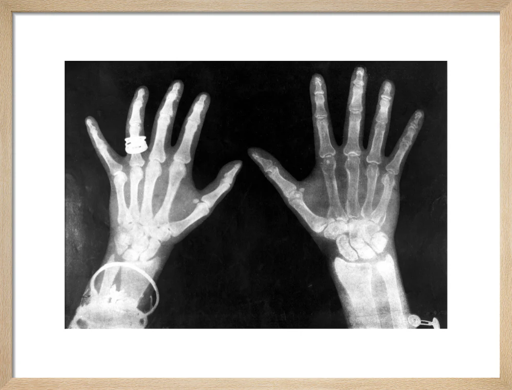 X-rays of the hands of King George and Queen Mary, 1896. - Image 82