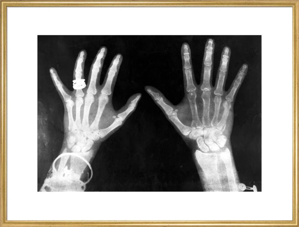 X-rays of the hands of King George and Queen Mary, 1896. - Image 91