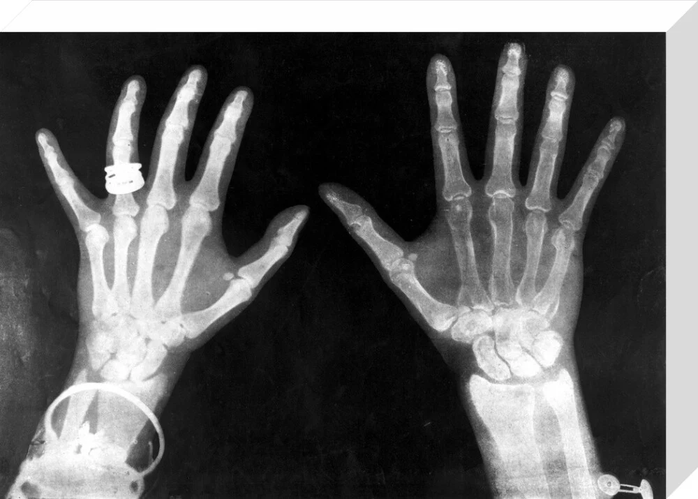 X-rays of the hands of King George and Queen Mary, 1896. - Image 98