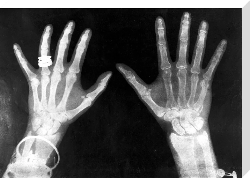 X-rays of the hands of King George and Queen Mary, 1896. - Image 99