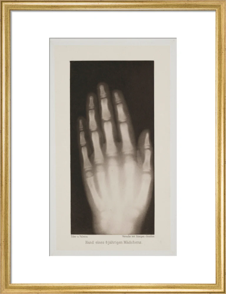 Hand of an 8 year-old girl, 1896. - Image 15