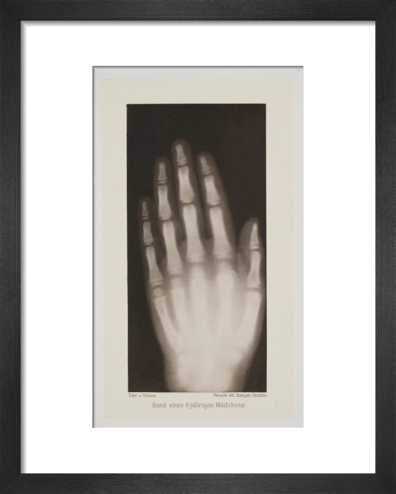 Hand of an 8 year-old girl, 1896. - Image 3
