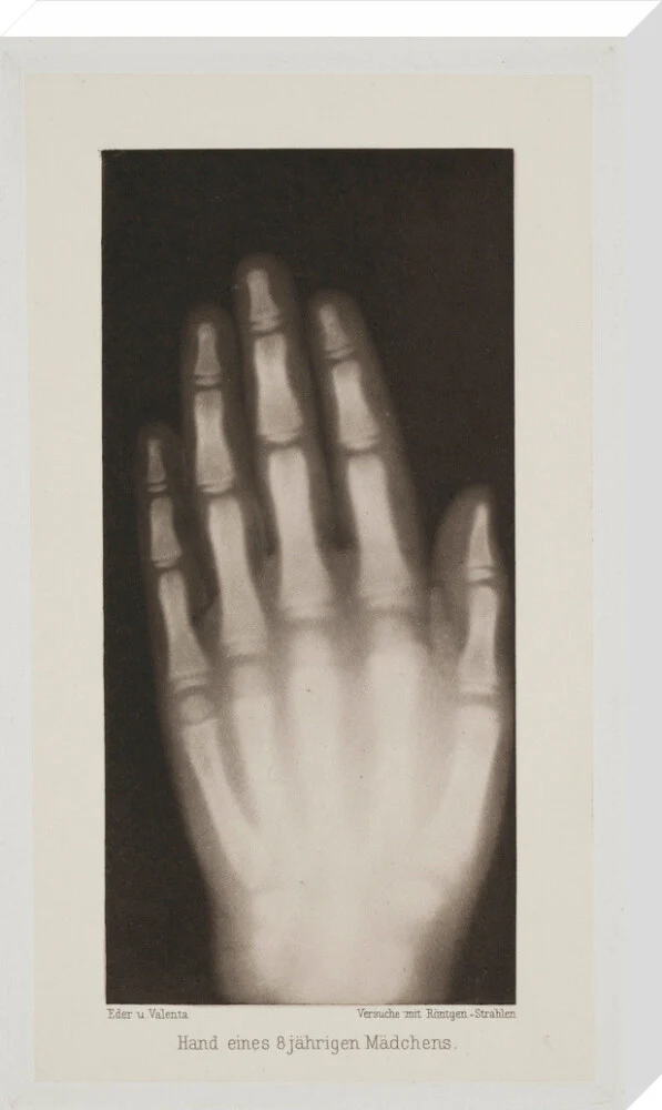 Hand of an 8 year-old girl, 1896. - Image 33
