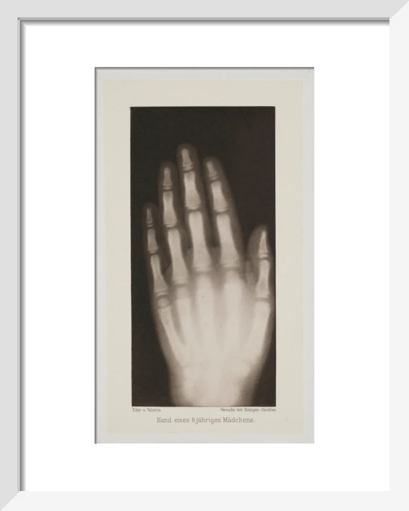 Hand of an 8 year-old girl, 1896. - Image 4