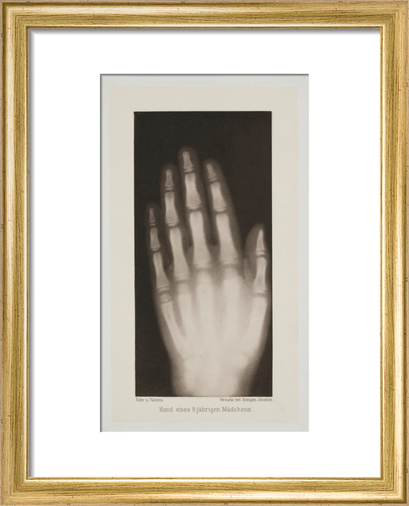 Hand of an 8 year-old girl, 1896. - Image 5