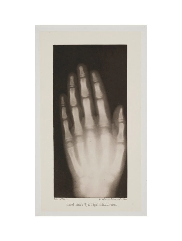Hand of an 8 year-old girl, 1896. - Image 50