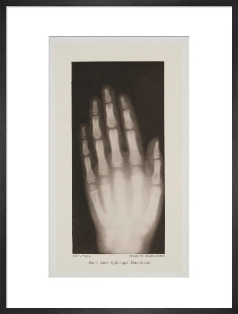 Hand of an 8 year-old girl, 1896. - Image 51