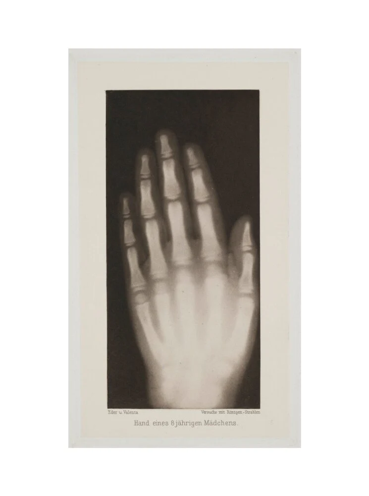 Hand of an 8 year-old girl, 1896. - Image 55