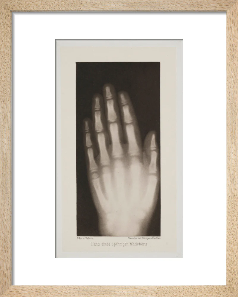 Hand of an 8 year-old girl, 1896. - Image 6