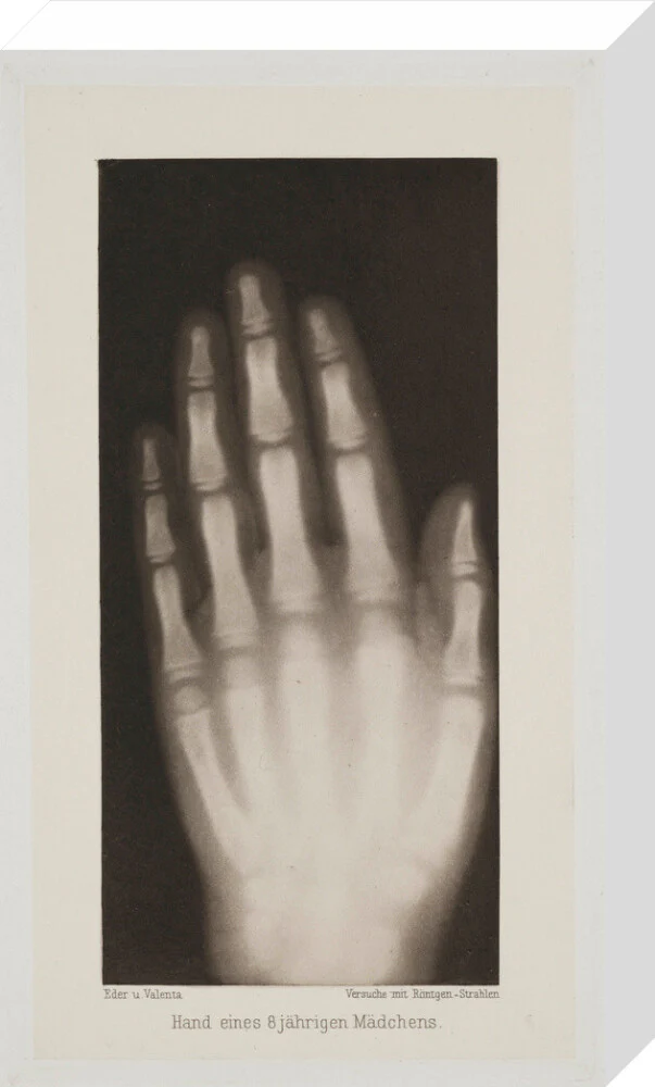 Hand of an 8 year-old girl, 1896. - Image 65