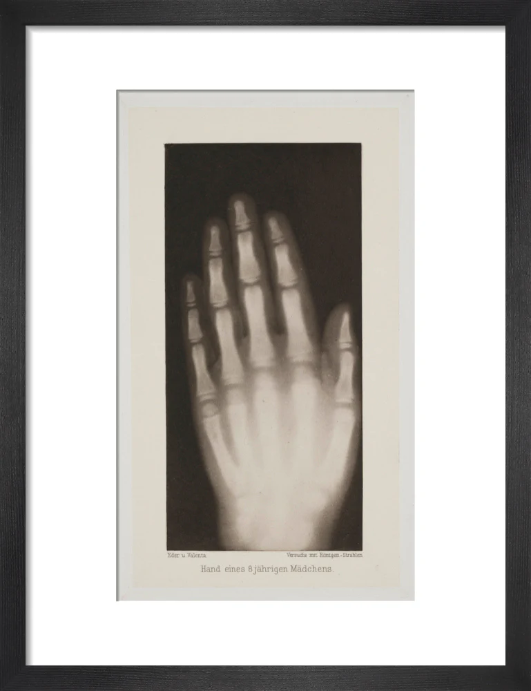 Hand of an 8 year-old girl, 1896. - Image 8