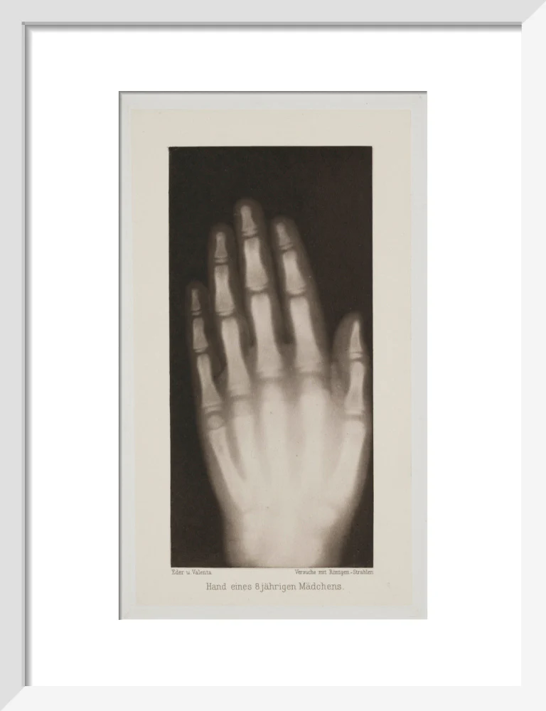 Hand of an 8 year-old girl, 1896. - Image 9